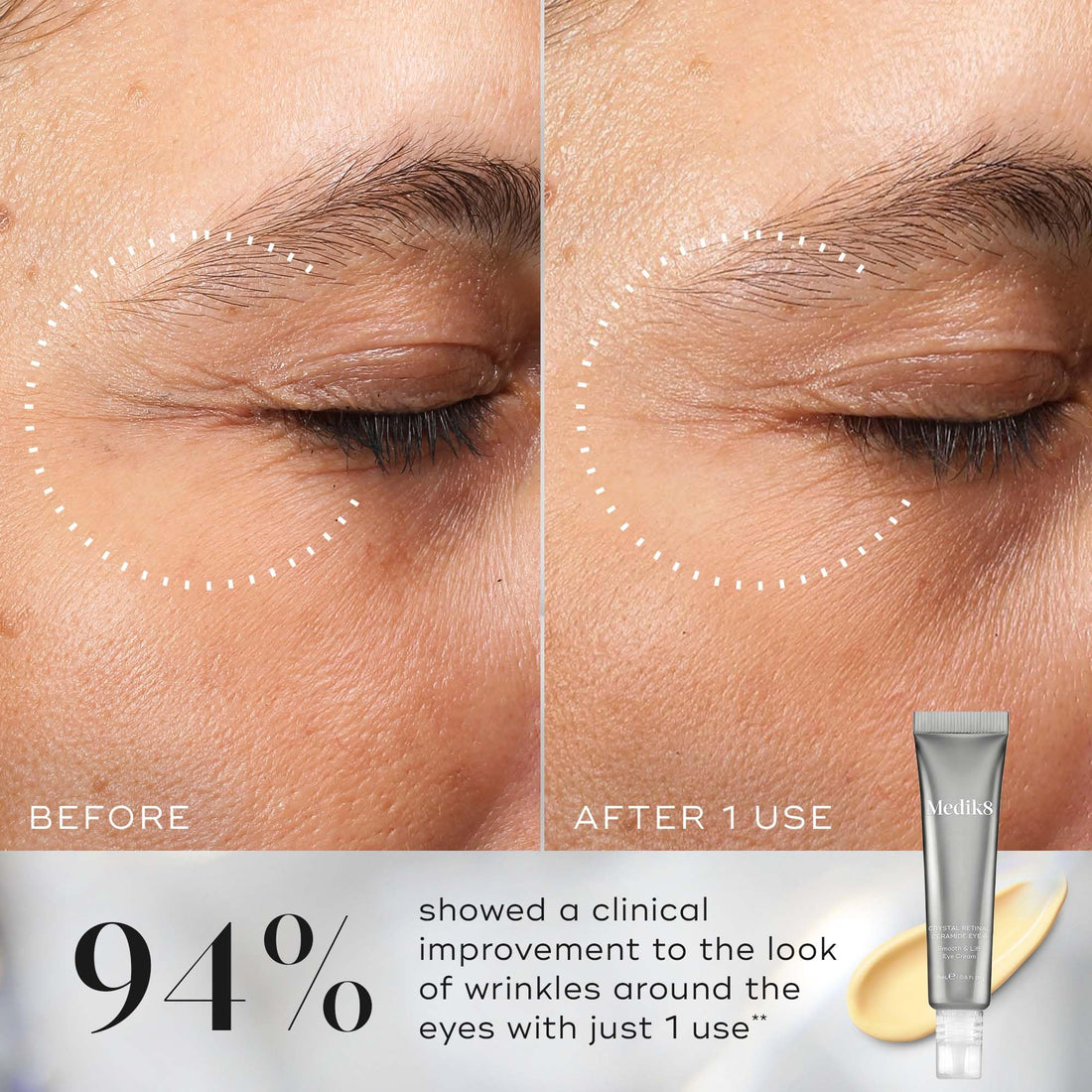 Medik8 Crema Contorno Occhi Crystal Retinal Ceramide Eye 10 15 ml — Contorno Occhi