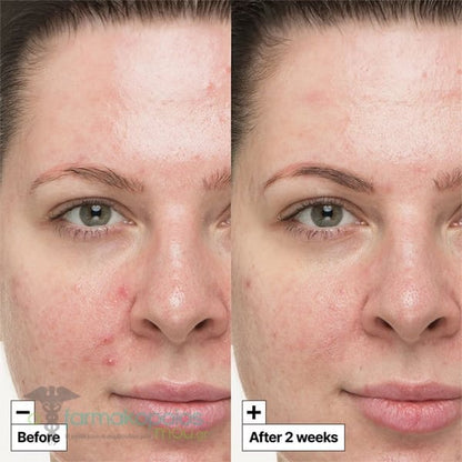 Dr. Jart+ Cicapair™ So Lenitivo 30ml — Crema Lenitiva
