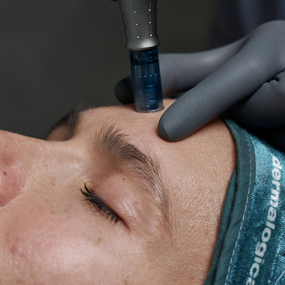 Dermalogica Pro Pen Penna Microneedling