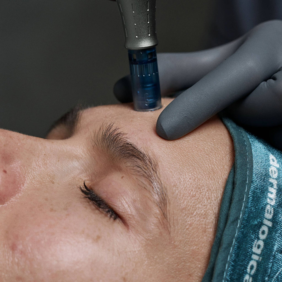 Dermalogica Pro Pen Penna Microneedling